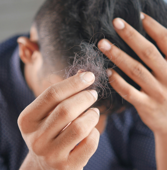 Hands adjusting short, thinning hair on the crown of the head.