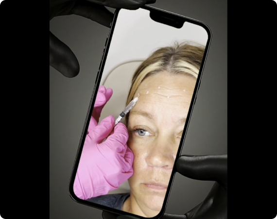 A medical professional administering a facial injection treatment, visible through a phone screen.