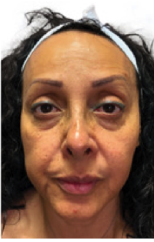 A woman wearing a headband, showing facial features and skin texture.