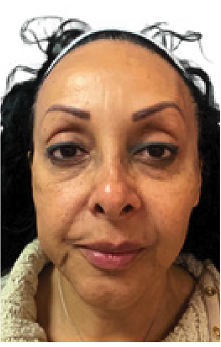 A woman wearing a headband, looking directly at the camera with neutral expression.